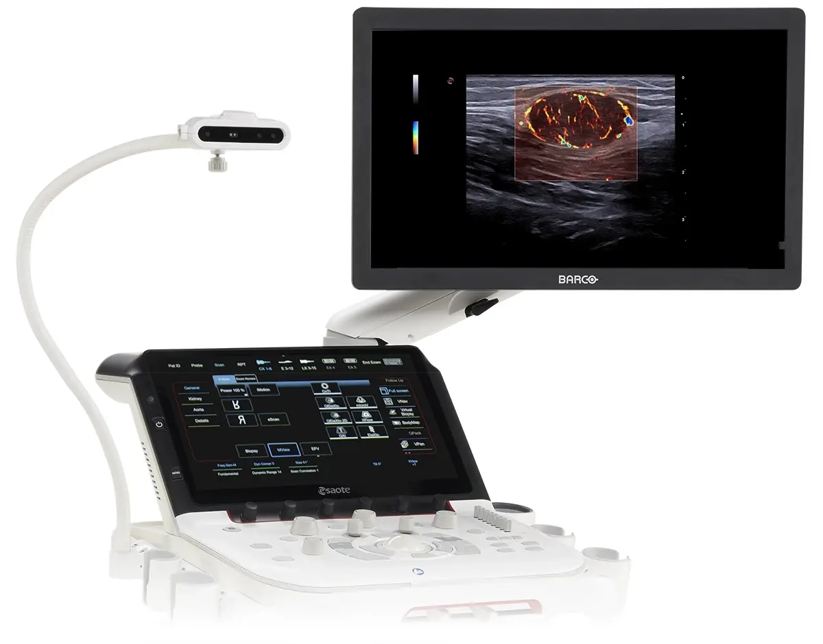 Ultrasonografi Cihazları